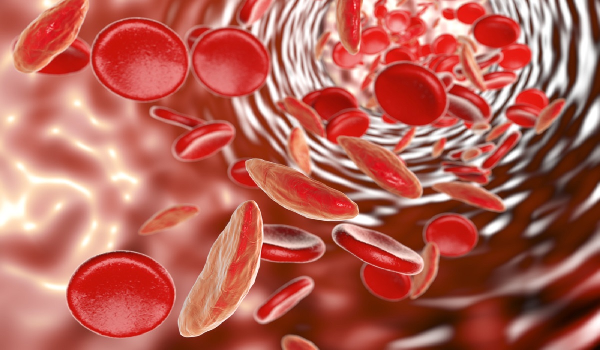 العلاقة بين فقر الدم والدورة الشهرية