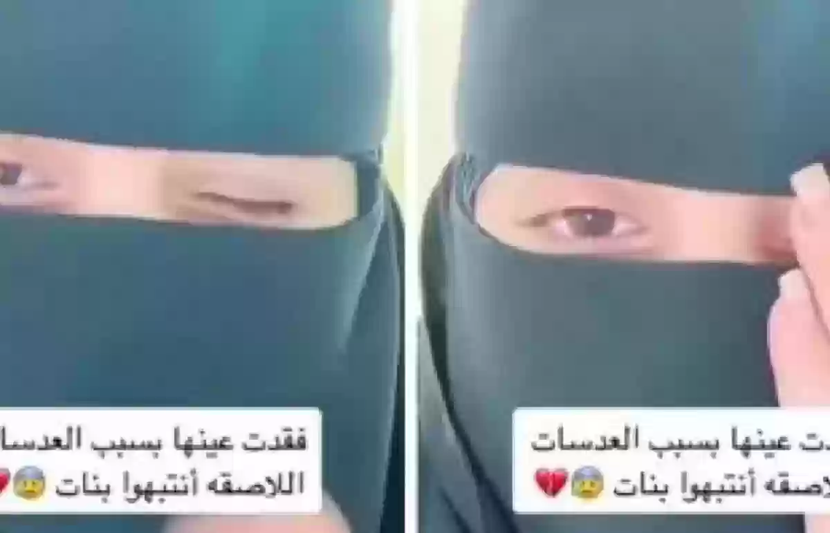  فتاة سعودية تحذر من استخدام العدسات اللاصقة وآثارها الجانبية..