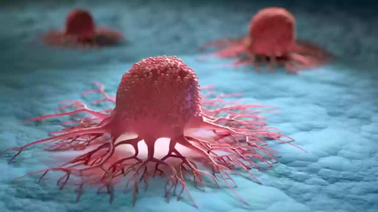 مختص يكشف عن طريقة حديثة للكشف عن الأورام السرطانية